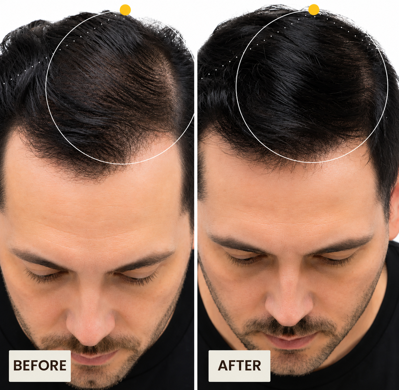 Seluntra Micro-Infusion Hair Revitalizer