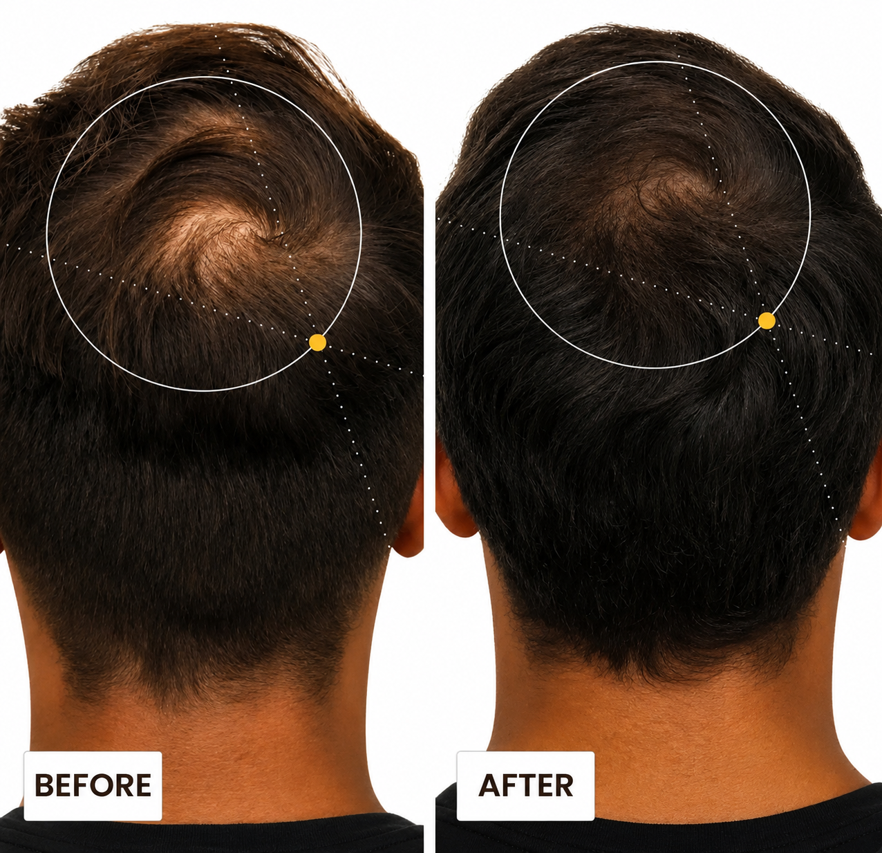 Seluntra Micro-Infusion Hair Revitalizer