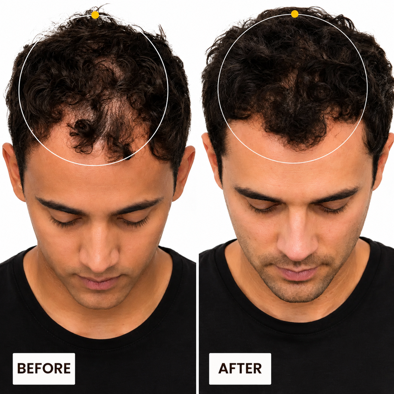 Seluntra Micro-Infusion Hair Revitalizer